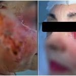 Imagem de rosto com feridas