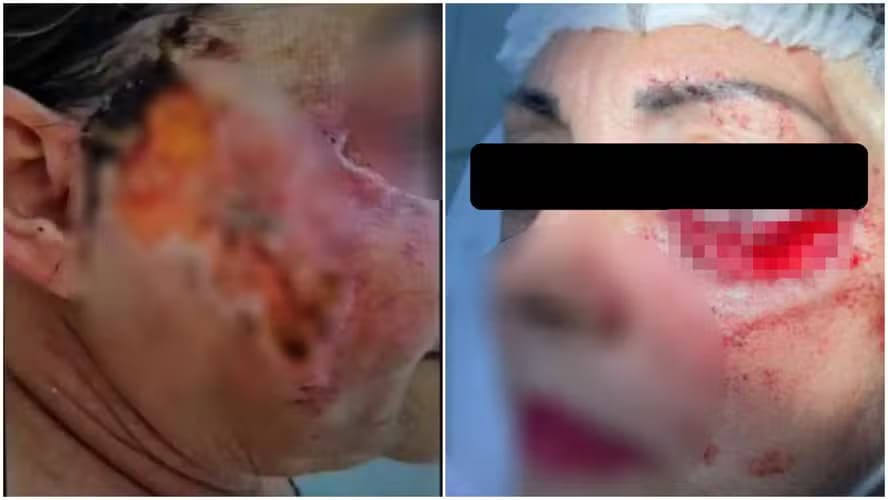 Imagem de rosto com feridas