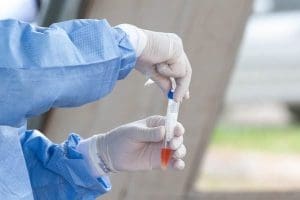 Imagem de enfermeira com teste de covid