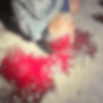 Imagem desfocada mostra a cabeça da vítima, que ainda está deitada no chão. Há muito sangue por perto.