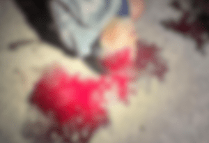 Imagem desfocada mostra a cabeça da vítima, que ainda está deitada no chão. Há muito sangue por perto.
