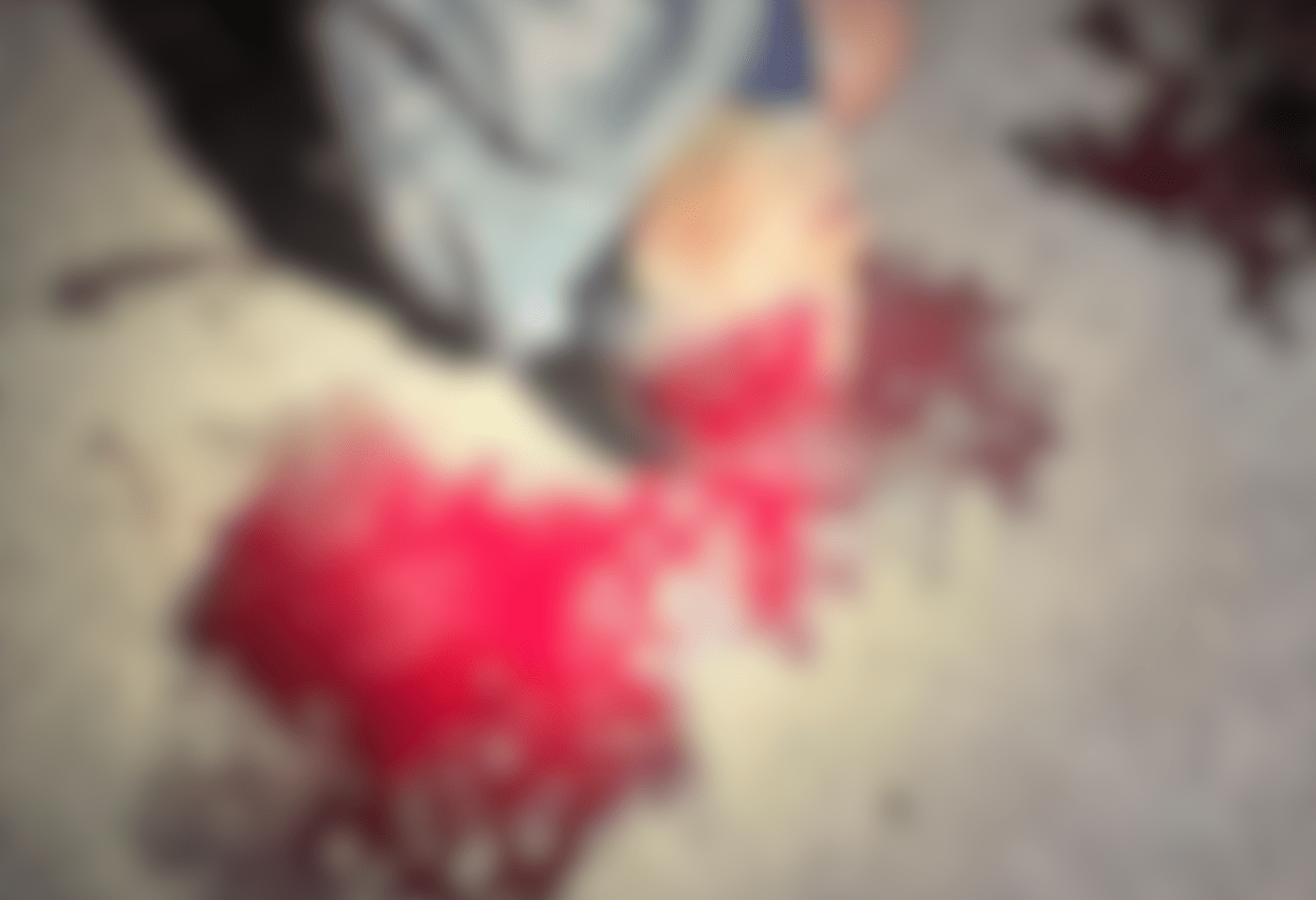 Imagem desfocada mostra a cabeça da vítima, que ainda está deitada no chão. Há muito sangue por perto.