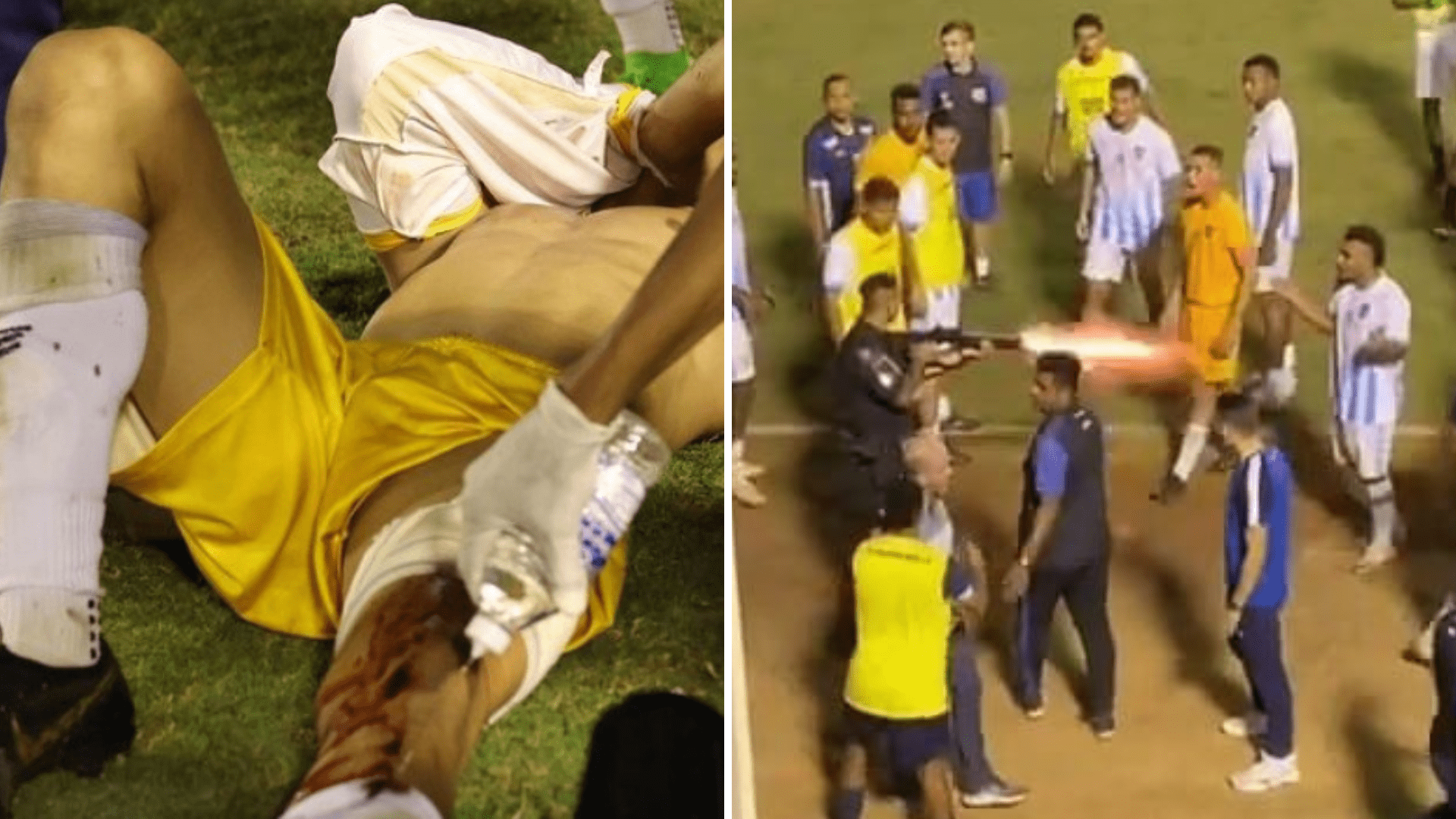 É uma montagem. Na foto da esquerda, um homem está deitado na grama, tampando o rosto com dor. Uma perda está dobrada, e a outra, estirada, está sangrando e recebendo primeiros socorros após ter sido baleada. Na imagem da direita, o momento em que o tiro é disparado: há vários jogadores em volta, o policial puxa o gatilho da arma, é possível ver o momento em que a bala é lançada.