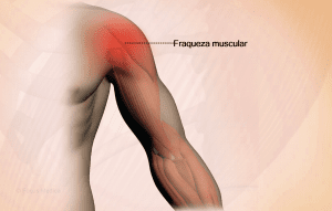 Imagem Braço inflamado imagem ilustrativa