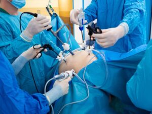 Imagem Cirurgia Bariátrica, médicos segurando equipamentos cirurgicos
