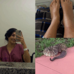 Imagem mulher, cobra e perna picada