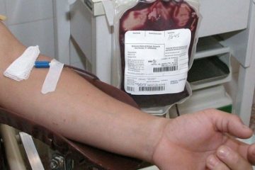 Imagem Doação de Sangue. Cateter está retirando sangue de uma pessoas, bolsa de sangue aparece cheia ao fundo.
