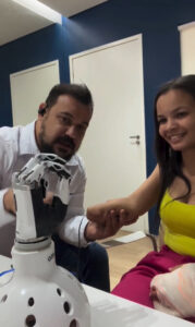Imagem mulher testando protese para colocar no braço, ela está sorrindo ao lado de um técnico que explica sobre a protese