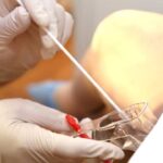 Imagem Exame Papa Nicolau, medico segura material que será usado na paciente