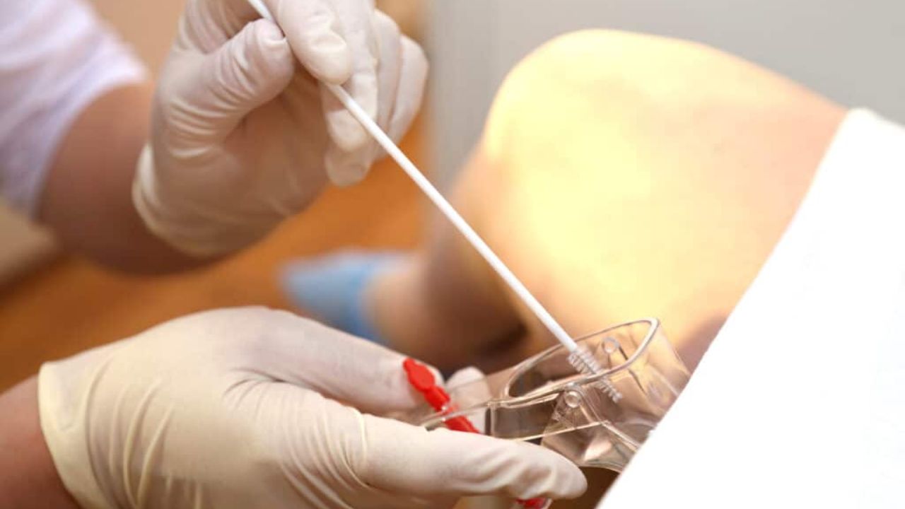 Imagem Exame Papa Nicolau, medico segura material que será usado na paciente