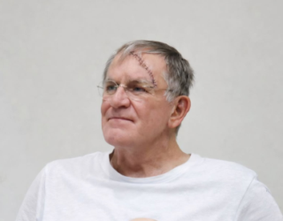 Imagem homem camisa branca com cicatriz na testa