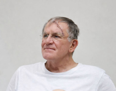 Imagem homem camisa branca com cicatriz na testa