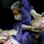 Imagem parto de bebês