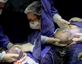 Imagem parto de bebês